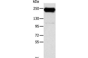 Western Blot analysis of K562 cell using RRBP1 Polyclonal Antibody at dilution of 1:400