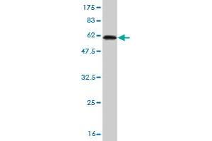 Western Blot detection against Immunogen (60. (RLBP1 Antikörper  (AA 1-317))