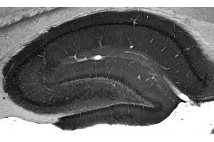 Adult rat hippocampus immunohistochemistry. (WASF1 Antikörper  (AA 477-498))