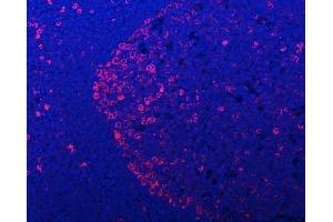 IF analysis of APP-1/PABPC4 using anti-APP-1/PABPC4 antibody (ABIN7603019).