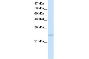 WB Suggested Anti-C20ORF20 Antibody Titration: 0. (MRGBP Antikörper  (Middle Region))