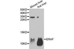 Western blot analysis of extracts of various cell lines, using AHSP antibody. (aHSP Antikörper)