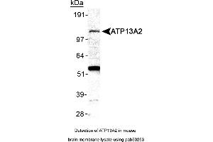 Image no. 2 for anti-ATPase Type 13A2 (ATP13A2) (AA 200-300), (Internal Region) antibody (ABIN363562) (ATP13A2 Antikörper  (Internal Region))
