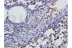 Formalin-fixed and paraffin embedded rat lung tissue labeled with Rabbit Anti-SGLT1 Polyclonal Antibody, Unconjugated (ABIN738066) 1:200 followed by conjugation to the secondary antibody and DAB staining (SLC5A1 Antikörper  (AA 401-500))