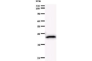 Western Blotting (WB) image for anti-BRCA1 Associated RING Domain 1 (BARD1) antibody (ABIN930988) (BARD1 Antikörper)