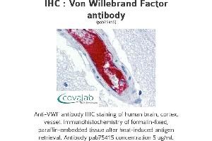 Image no. 1 for anti-Von Willebrand Factor (VWF) antibody (ABIN1740780) (VWF Antikörper)