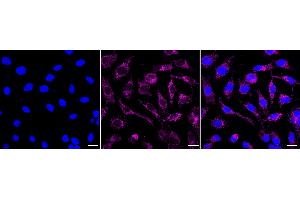 Immunocytochemical staining of HeLa cells with NDUFAF1 antibody (ABIN7799543), 1:1,000).