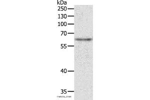 Western blot analysis of Jurkat cell, using TRAF3IP2 Polyclonal Antibody at dilution of 1:500