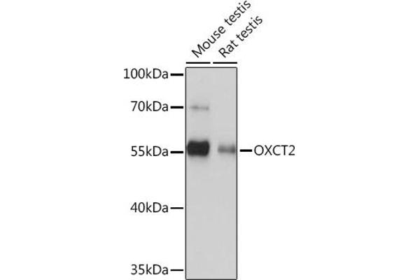 OXCT2 Antikörper  (AA 430-510)
