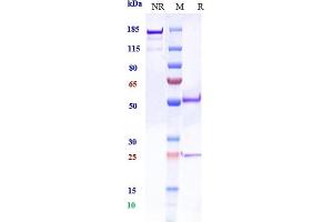 Anti-PCSK9 Reference Antibody (RG7652) on SDS-PAGE under reducing (R) condition.