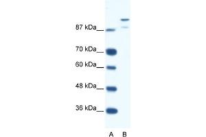 WB Suggested Anti-HKR1 Antibody Titration:  0. (HKR1 Antikörper  (N-Term))
