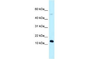 WB Suggested Anti-1110059E24Rik Antibody Titration: 1. (1110059E24Rik Antikörper  (N-Term))