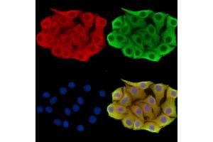 ABIN7095895 and ABIN7099957 staining Hela cells by IF/ICC. (RDH12 Antikörper)