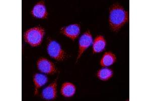 IF analysis of Nicastrin/NCSTN using anti-Nicastrin/NCSTN antibody (ABIN7601402).