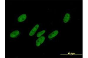 Immunofluorescence of purified MaxPab antibody to ZNF777 on HepG2 cell. (ZNF777 Antikörper  (AA 1-518))