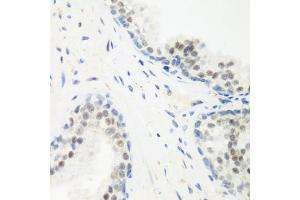 Immunohistochemistry of paraffin-embedded human prostate using PPAN antibody (ABIN6133157, ABIN6145994, ABIN6145996 and ABIN6223238) at dilution of 1:200 (40x lens). (PPAN Antikörper  (AA 1-300))