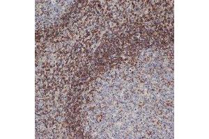 Immunohistochemistry (IHC) image for anti-B-Cell CLL/lymphoma 2 (BCL2) antibody (ABIN2477599) (Bcl-2 Antikörper)