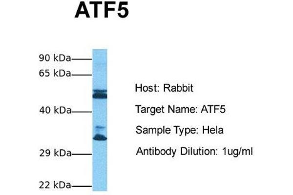 ATF5 Antikörper  (N-Term)