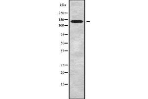 Western blot analysis of ATP2B2 using COLO205 whole cell lysates (ATP2B2 Antikörper  (N-Term))