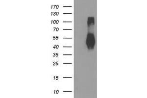 Western Blotting (WB) image for anti-Transmembrane Protein with EGF-Like and Two Follistatin-Like Domains 2 (TMEFF2) antibody (ABIN1501416) (TMEFF2 Antikörper)