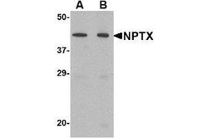 Western blot analysis of NPTX2 in mouse brain tissue lysate with NPTX2 antibody at (A) 0.