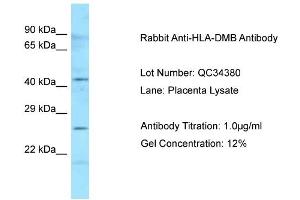 Host: Rabbit Target Name: HLA-DMB Sample Type: Human Placenta Antibody Dilution: 1. (HLA-DMB Antikörper  (N-Term))