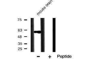 Western blot analysis of PAK1 expression in mouse brain tissue lysates,The lane on the right is treated with the antigen-specific peptide. (PAK1 Antikörper  (Internal Region))