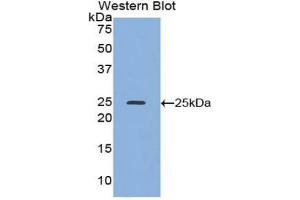 Detection of Recombinant ADH1, Mouse using Polyclonal Antibody to Alcohol Dehydrogenase 1 (ADH1) (ADH1 Antikörper  (AA 25-228))