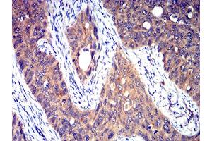 Immunohistochemistry (IHC) image for anti-Serotonin Receptor 3A (HTR3A) (AA 24-157) antibody (ABIN5611116)