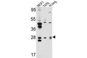 Image no. 1 for anti-E74-Like Factor 5 (Ets Domain Transcription Factor) (ELF5) (Middle Region) antibody (ABIN452951) (ELF5 Antikörper  (Middle Region))