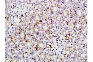 Immunohistochemistry (Paraffin-embedded Sections) (IHC (p)) image for anti-Solute Carrier Family 2 (Facilitated Glucose Transporter), Member 4 (SLC2A4) (AA 401-509) antibody (ABIN739445)