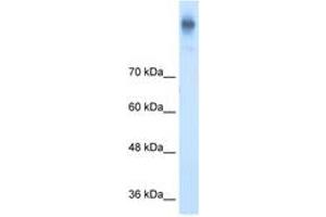 Image no. 1 for anti-Solute Carrier Family 12 (Potassium-Chloride Transporter) Member 2 (SLC12A2) (AA 1101-1150) antibody (ABIN205009) (SLC12A2 Antikörper  (AA 1101-1150))