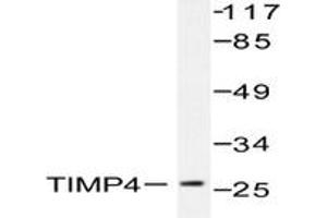Image no. 1 for anti-TIMP Metallopeptidase Inhibitor 4 (TIMP4) antibody (ABIN271963) (TIMP4 Antikörper)