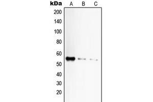Western blot analysis of CD120a expression in HeLa (A), mouse liver (B), rat liver (C) whole cell lysates. (TNFRSF1A Antikörper  (C-Term))