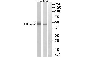 Western blot analysis of extracts from HepG2 cells and HuvEc cells, using EIF2S2 antibody. (EIF2S2 Antikörper  (Internal Region))