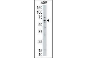 MLLT1 Antikörper  (C-Term)