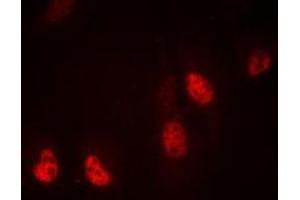 Immunofluorescent analysis of RPL36 staining in MDAMB435 cells. (RPL36 Antikörper  (Center))