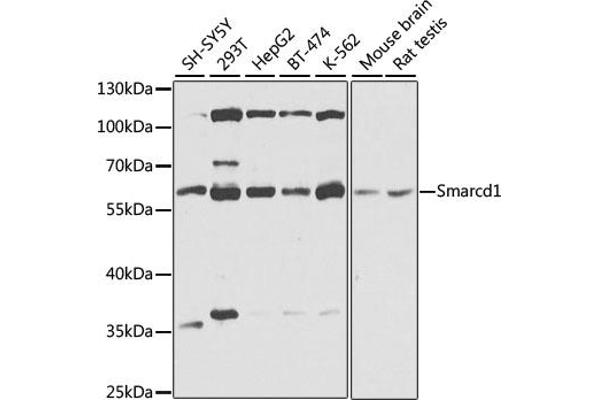 SMARCD1 Antikörper  (AA 1-120)