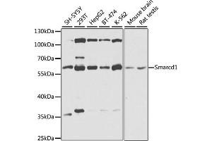 Western blot analysis of extracts of various cell lines, using Smarcd1 antibody (ABIN6132669, ABIN6137420, ABIN6137421 and ABIN6225284) at 1:1000 dilution.