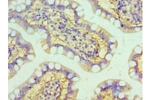 Immunohistochemistry of paraffin-embedded human small intestine tissue using ABIN7155973 at dilution of 1:100 (HYAL3 Antikörper  (AA 198-417))