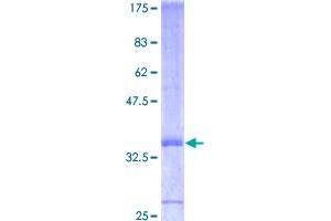 Image no. 1 for Fibroblast Growth Factor 7 (FGF7) (AA 1-97) protein (GST tag) (ABIN1354022)