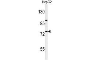 Western blot analysis of ZNF202 Antibody (Center) in HepG2 cell line lysates (35 µg/lane). (ZNF202 Antikörper  (Middle Region))