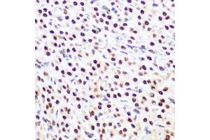 Immunohistochemistry of paraffin-embedded rat ovary using SP3 Rabbit pAb (ABIN6130701, ABIN6148314, ABIN6148315 and ABIN6216542) at dilution of 1:100 (40x lens). (Sp3 Antikörper  (AA 240-350))