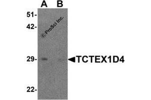 Western Blotting (WB) image for anti-Tctex1 Domain Containing 4 (TCTEX1D4) (N-Term) antibody (ABIN1587950)
