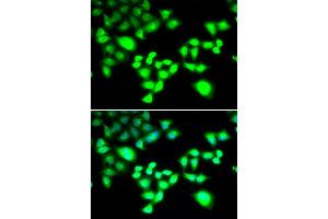 Immunofluorescence analysis of MCF-7 cells using RAD1 antibody (ABIN5995531).