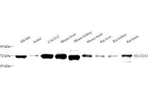 Western blot analysis of SLC22A1 (ABIN7075663) at dilution of 1: 1000 (SLC22A1 Antikörper)