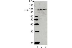 Western blot analysis of AhR, pAb : Lane 1: MW marker, Lane 2: Rat liver lysate, Lane 3: Mouse liver lysate. (Aryl Hydrocarbon Receptor Antikörper  (AA 1-402))