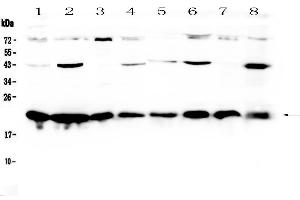 Western blot analysis of HP1 gamma using anti-HP1 gamma antibody . (CBX3 Antikörper  (AA 2-183))