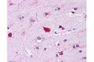 Immunohistochemistry (IHC) image for anti-Fatty Acid Binding Protein 4, Adipocyte (FABP4) (Middle Region) antibody (ABIN2778217) (FABP4 Antikörper  (Middle Region))