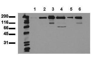 Western Blotting (WB) image for anti-Receptor Tyrosine-Protein Kinase ErbB-3 (ERBB3) (AA 1250-1270), (Cytoplasmic Domain) antibody (ABIN126794) (ERBB3 Antikörper  (Cytoplasmic Domain))